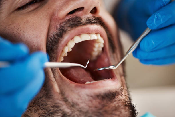 Best Emergency Root Canal Treatment in East Jordan, MI