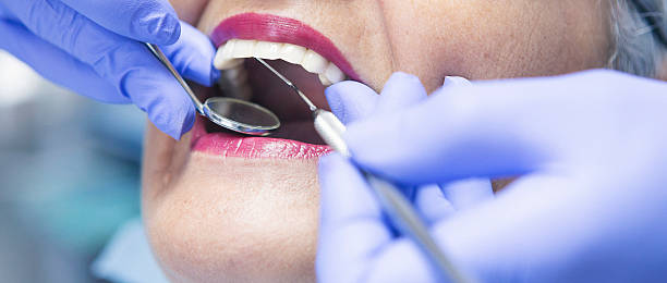 Best Emergency Dentist for Knocked-Out Tooth in East Jordan, MI